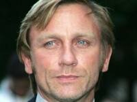 Daniel Craig&acute;s &acute;lesbian&acute; surgery fears